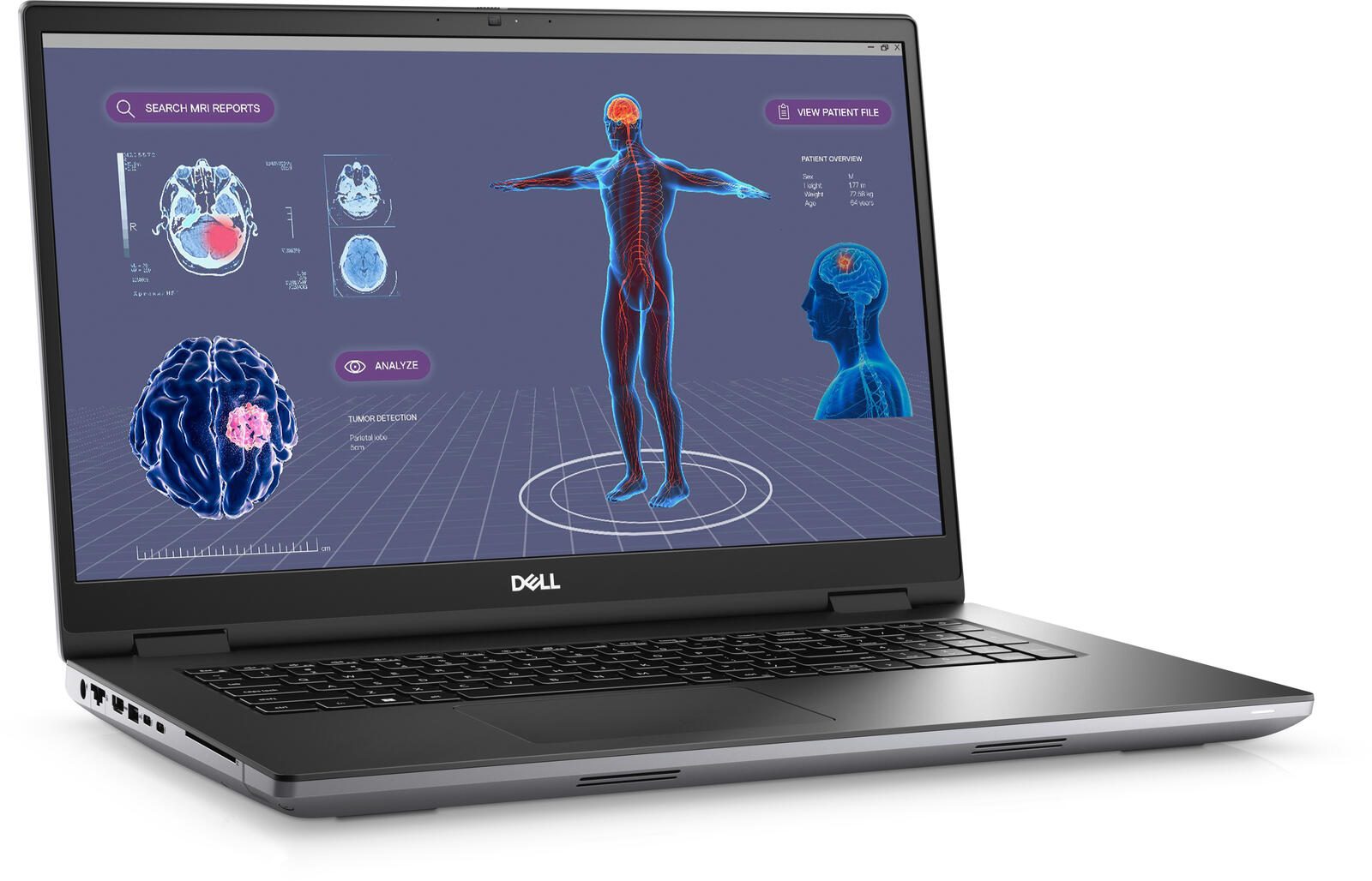 Dell Precision 7780 Intel® Core™ i9-13950HX Mobile Workstation 43,9 cm (17,3')