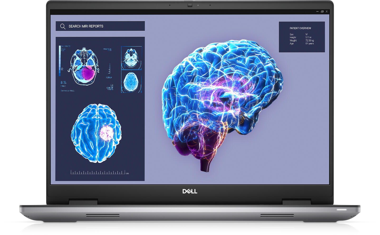 Dell Precision 7680 Intel® Core™ i7-13850HX Mobile Workstation 40,6 cm (16')