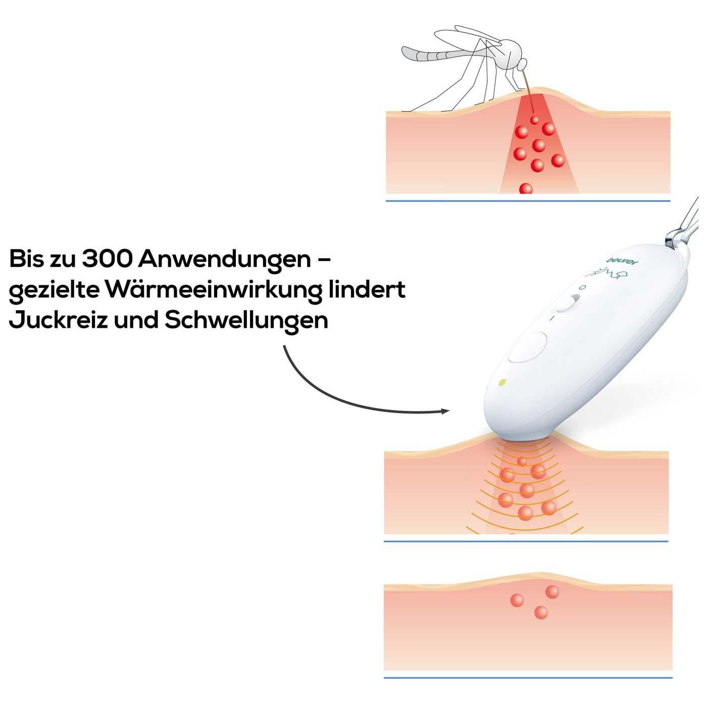 beurer BR 10 Stichheiler